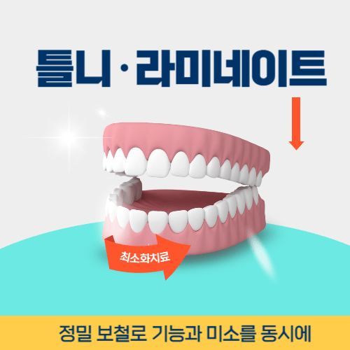 신논현역틀니라미네이트