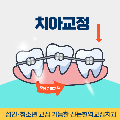 신논현역치아교정