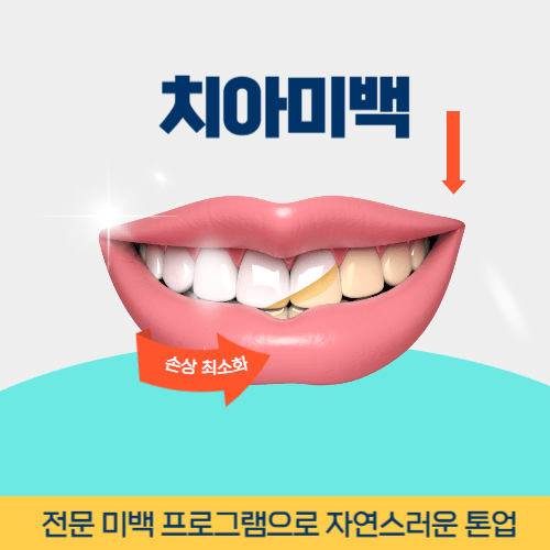 신논현역치아미백
