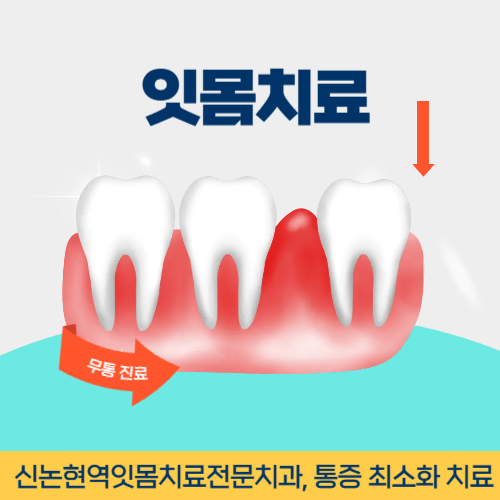 신논현역잇몸치료